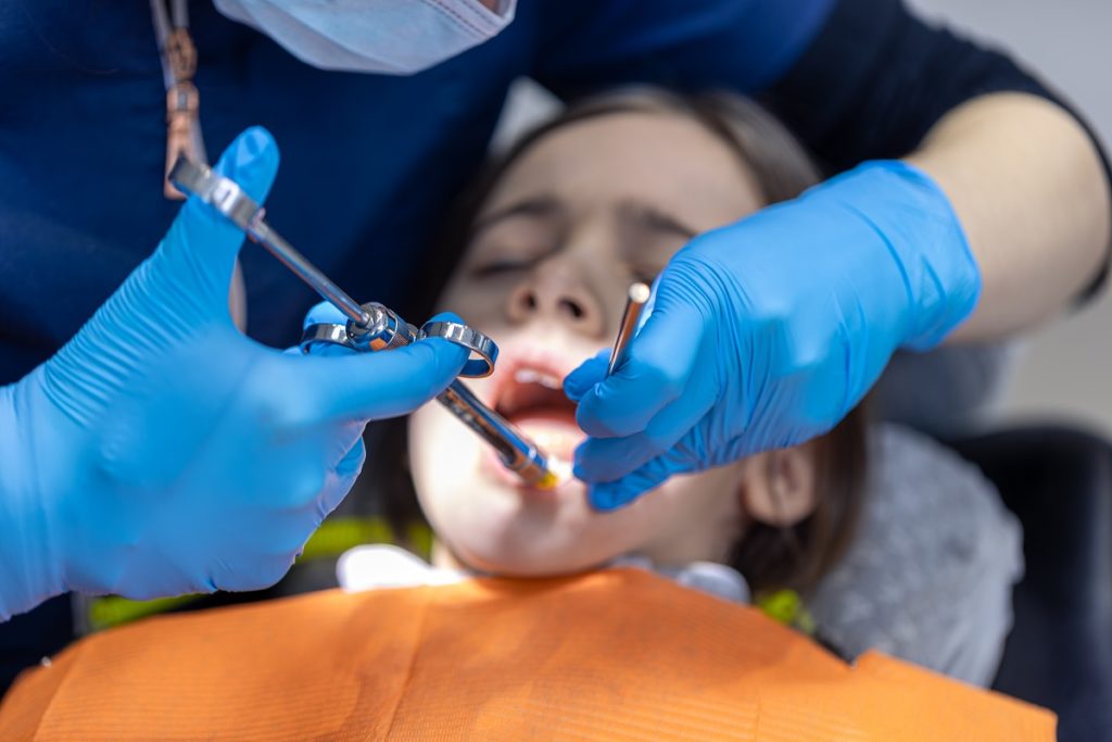 IPR in Invisalign